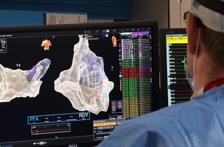 Najnowsza technologia ablacji dostępna dla szerszej grupy pacjentów