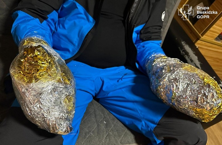 Hipotermia i odmrożenia na Babiej Górze