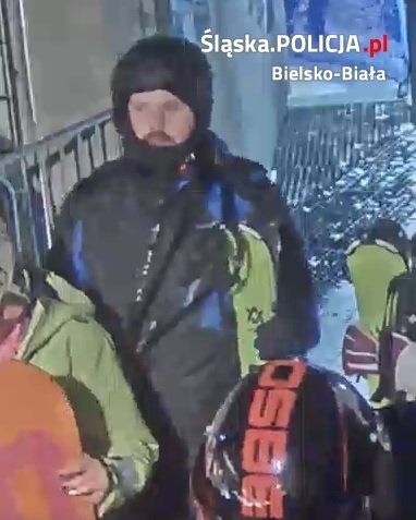 Policja poszukuje sprawcy uszkodzenia ciała