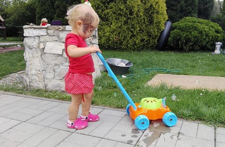 Agatka potrzebuje pomocy